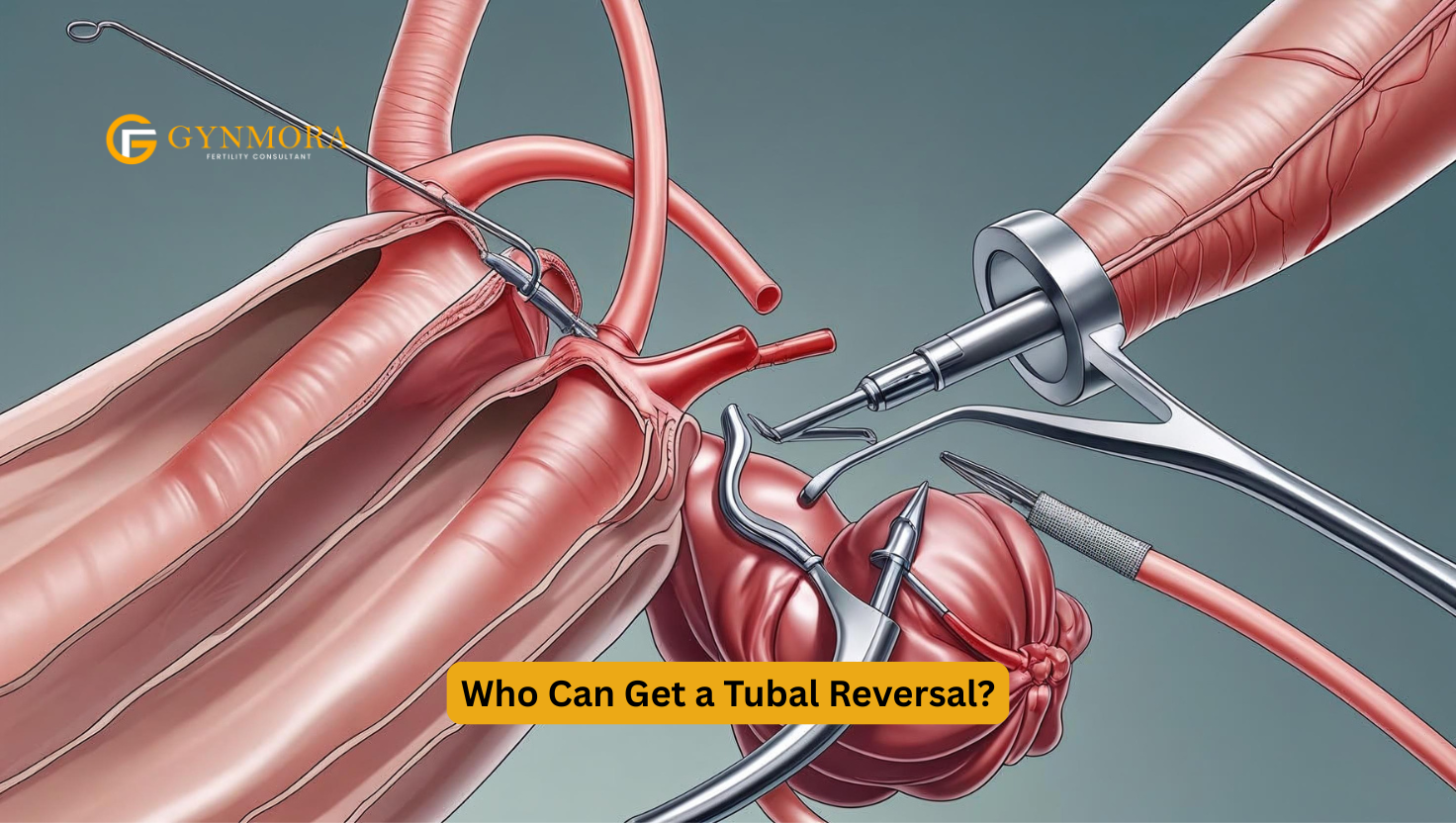 Tubal Ligation Reversal San Antonio TX