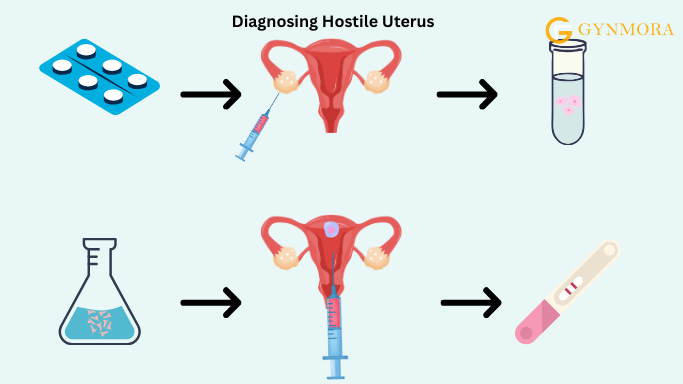 Hostile Uterus: 5 Alarming Symptoms You Can’t Ignore