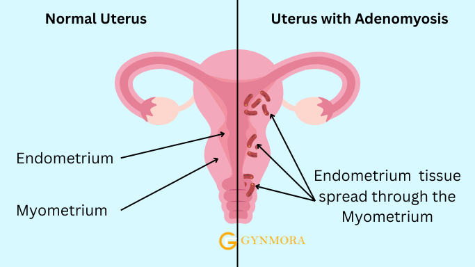 Hostile Uterus: 5 Alarming Symptoms You Can’t Ignore